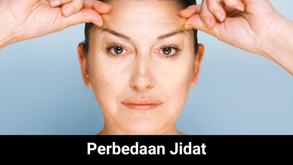 Perbedaan Jidat Jenong Dan Lebar. Perbedaan Jidat Jenong dan Lebar